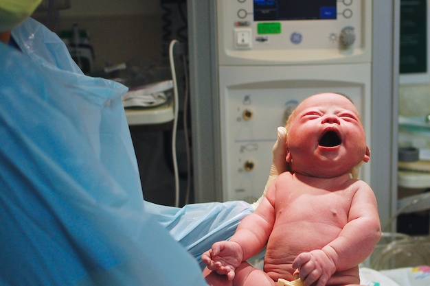 down-syndrome-baby-boy-new-born-2.jpg